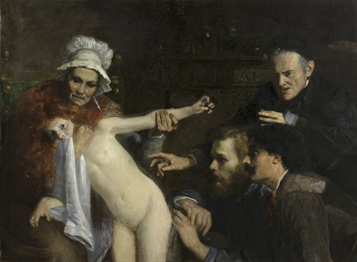 Quand la médecine se cache au musée. Diagnostiquer des maladies de la peau à travers des œuvres